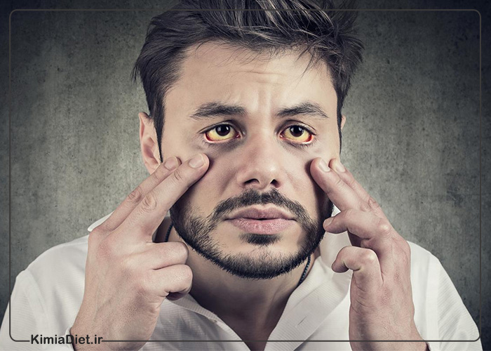 15 - رژیم درمانی کیمیا